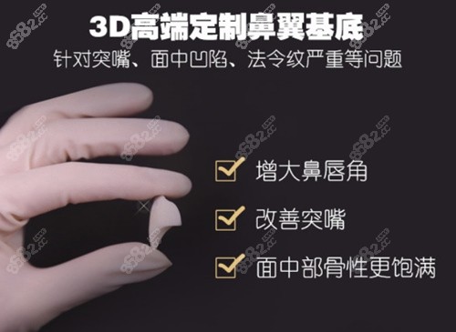 王艇3D定制鼻翼基底优势介绍