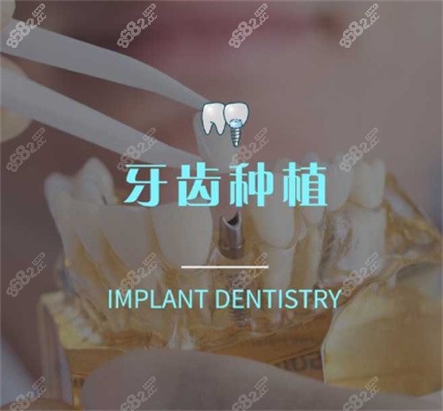上海悦康口腔牙齿种植