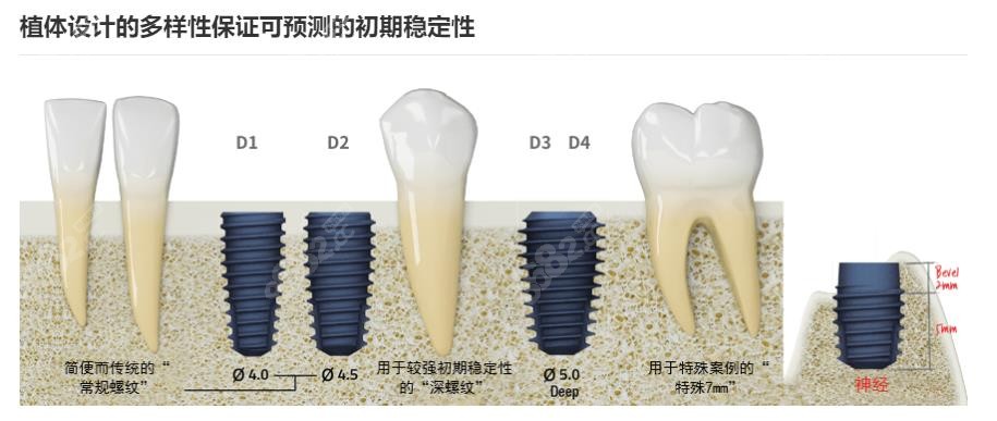 美格真any one型号介绍