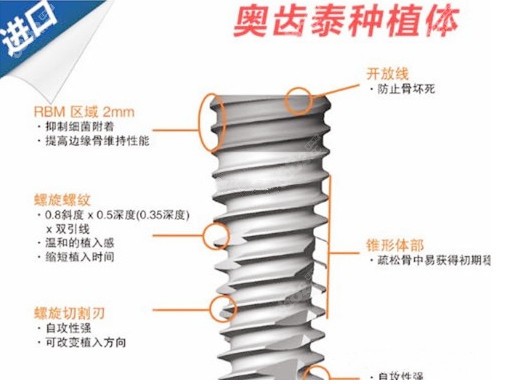 奥齿泰种植体