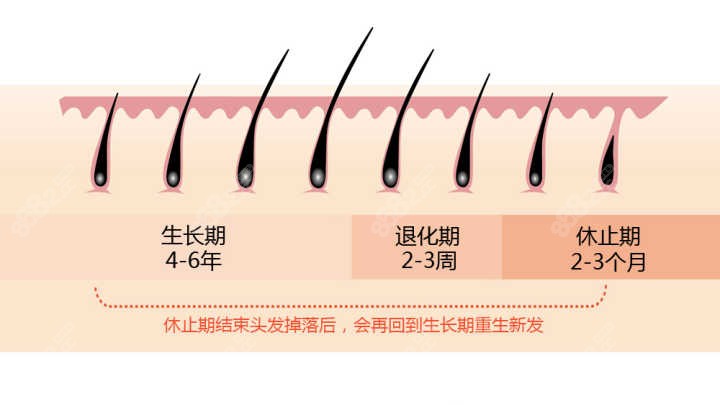 植发的脱落期也不担忧