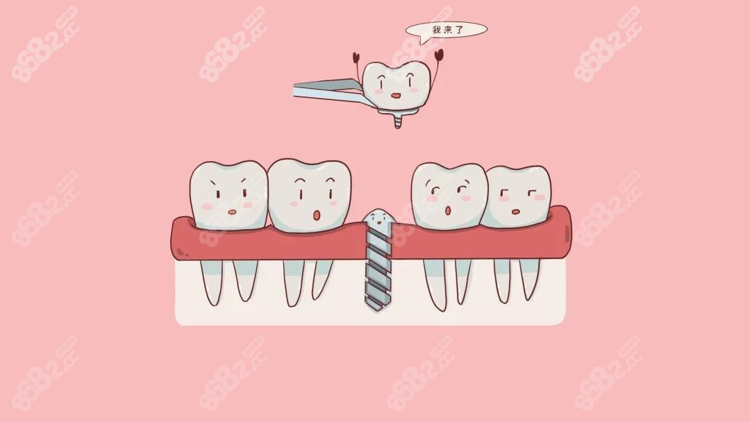 宁波鄞州种植牙医院排名 宁波鄞州种植牙医院排名