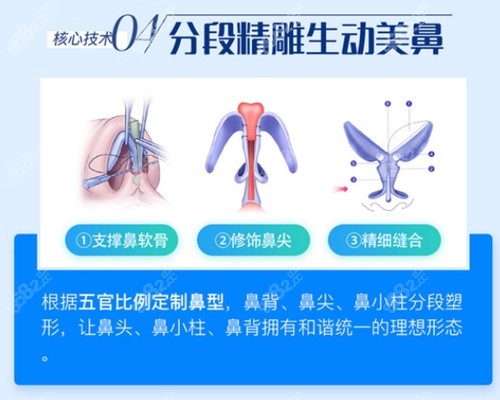 广州曙光隆鼻技术