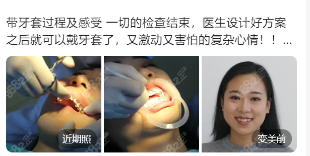 北京圣貝口腔劉雪蓮醫(yī)生好評