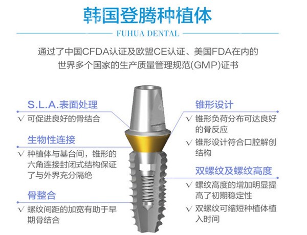 韩国登腾种植体的设计优势