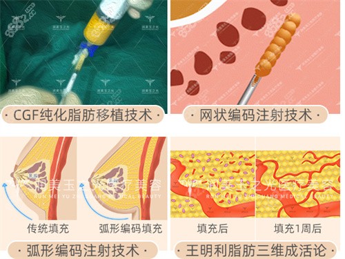 北京润美玉之光王明利脂肪填充技术