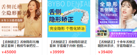 北京舌側(cè)矯正活動價格