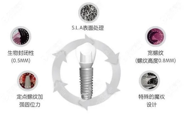 韩国纽百特Neo种植体的设计特点