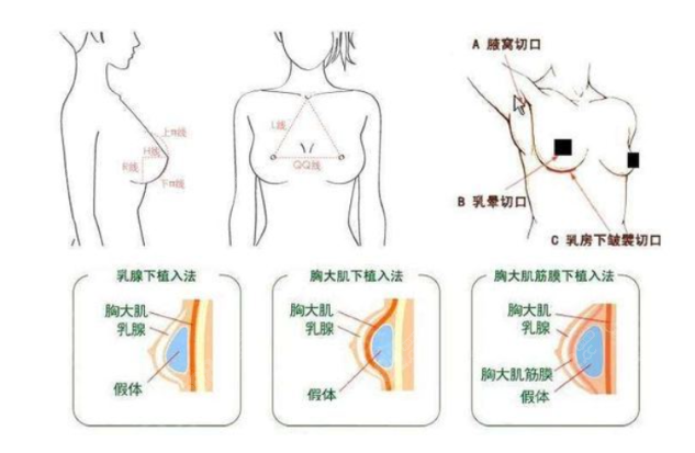 胸部示意图