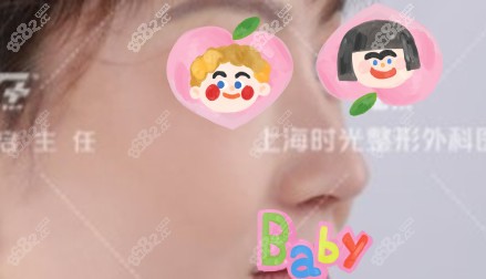 上海時(shí)光宋茂啟做4D彈性保留鼻術(shù) 上海時(shí)光宋茂啟做4D彈性保留鼻術(shù)