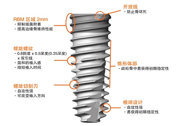 奥齿泰种植体的优点