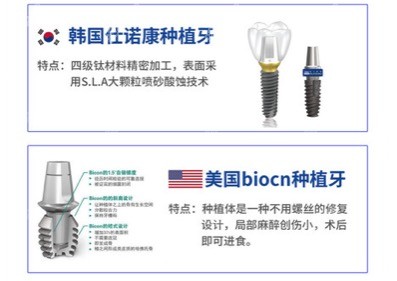 杭州西湖口腔医院种植体