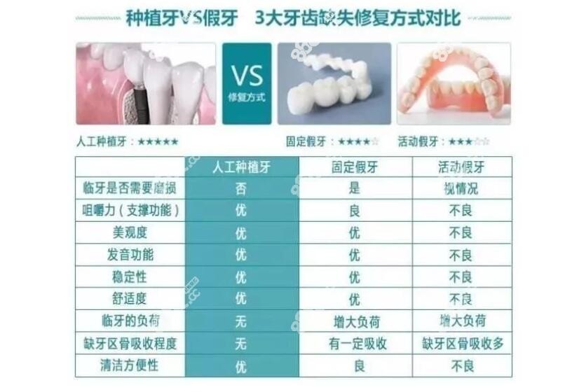 种植牙和活动假牙的区别