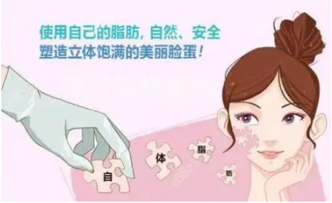 北京脂肪填充哪家醫(yī)院好呢？