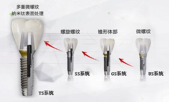 韩国奥齿泰型号众多