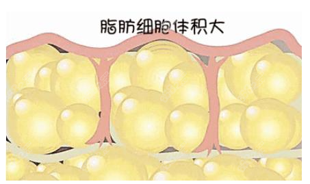 北京脂肪填充哪個醫(yī)生好呢？