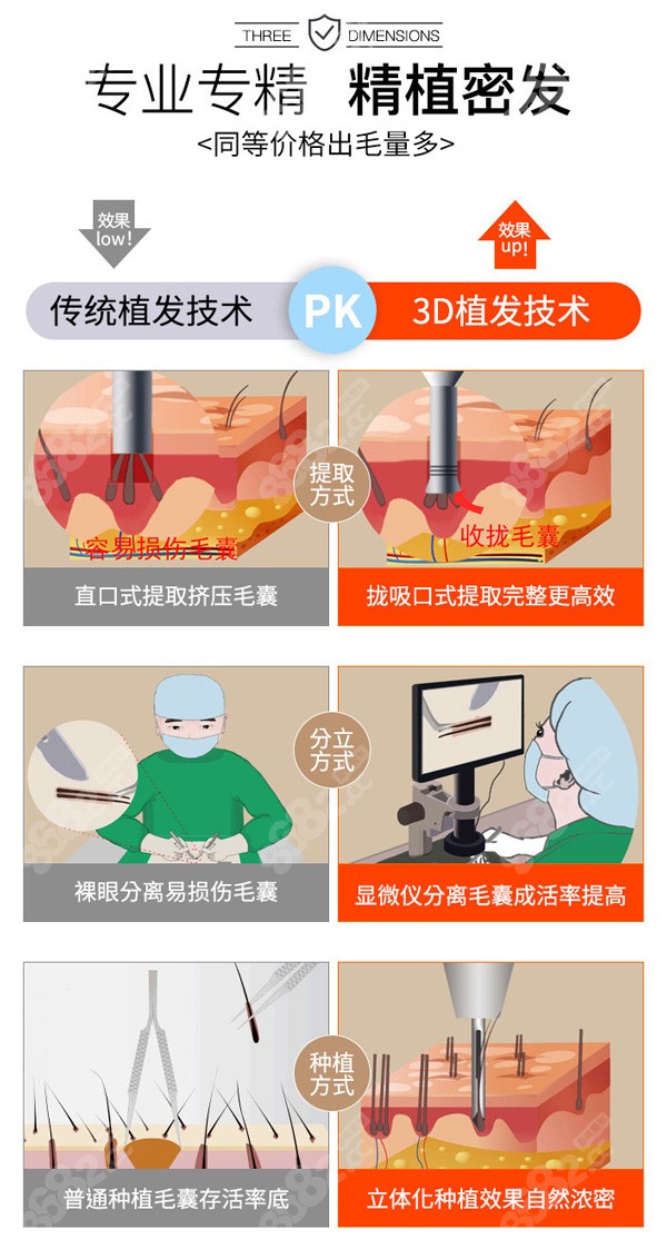 北京<!--<i data=20240705-sp></i>-->植发3D植发技术和传统植发区别