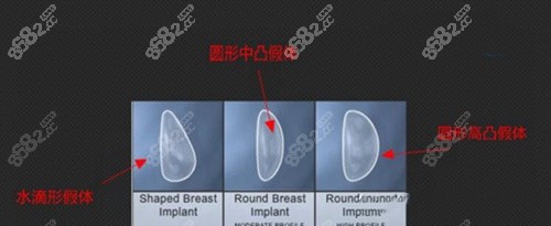 假体隆胸中凸和高凸哪个好看