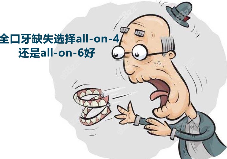 全口缺失all-on-4还是all-on-6好