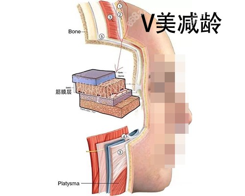 北京加减美医院拉皮手术