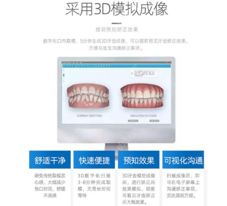 牙齿矫正优势