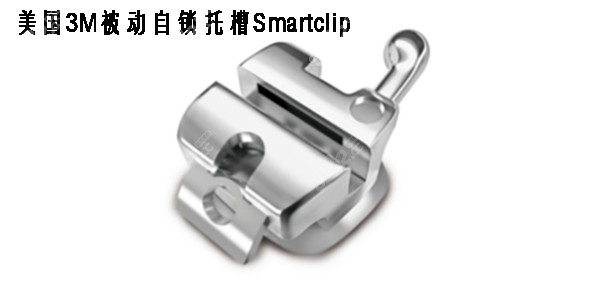 美国3M金属自锁SmartClip矫治器