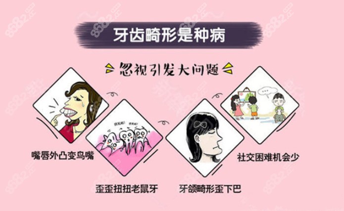 来看看哪些牙齿情况需要进行矫正吧