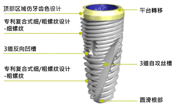 韩国neo种植体的特点