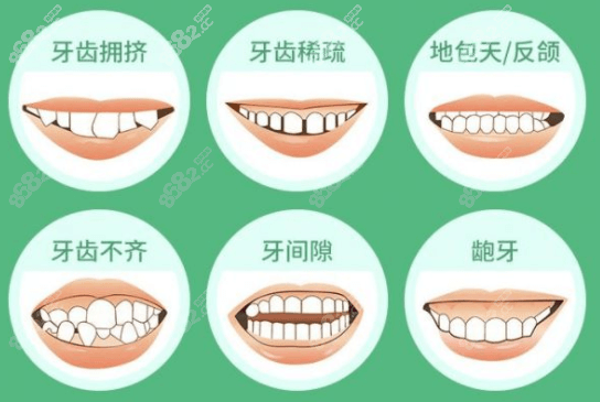 义务傅氏口腔价格合理不算贵但具体多少要结合项目和牙齿情况来定