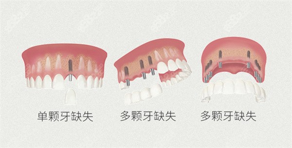 正规的口腔专科医院或门诊部