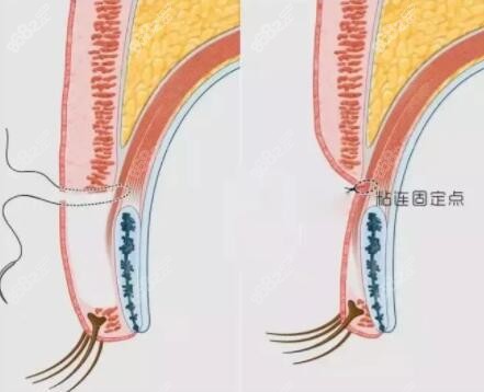 画双眼皮教程图解图片