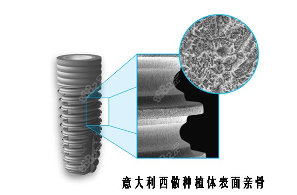 意大利西傲种植体OGI亲骨表面