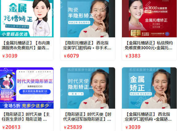 西安戴牙套一般价格参考