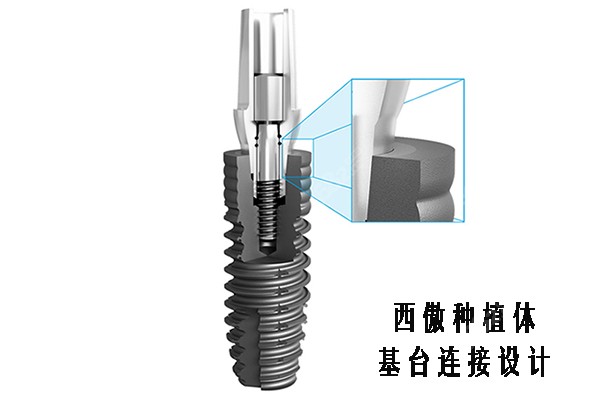 意大利西傲种植体6°摩尔氏锥度连接设计
