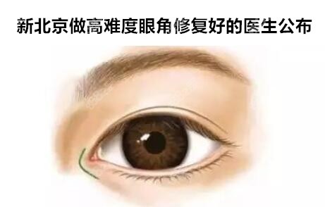 新北京做高难度眼角修复好的医生名单公布
