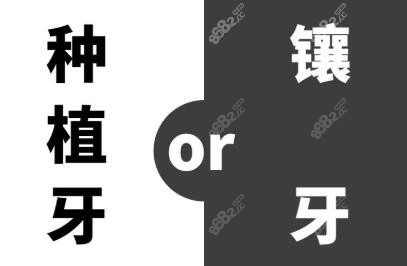种牙和镶牙哪个好