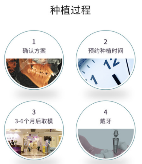 淄博张店区种植牙哪家好？