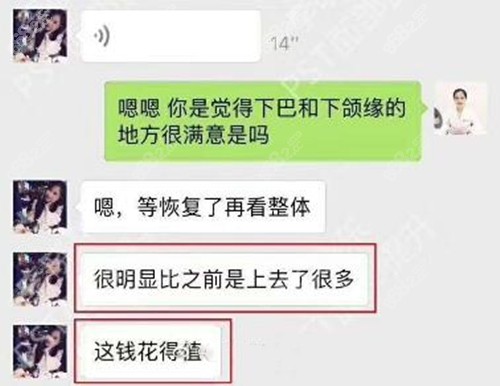 北京李晓东pst面部提升术后反馈