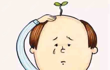 头顶稀疏在上海做植发得多少钱,我头发少但没掉完能植发吗,脱发治疗