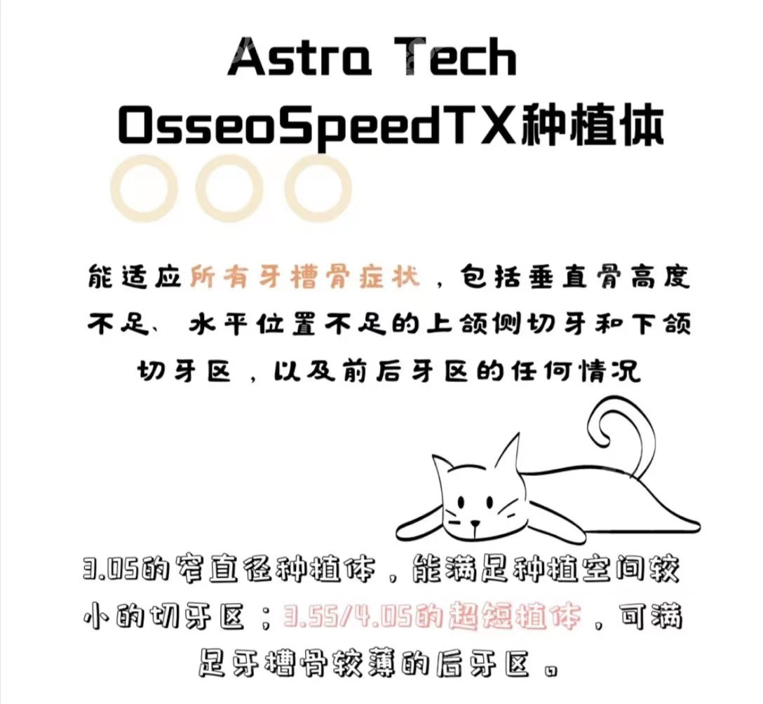 瑞典astra种植体的型号及规格