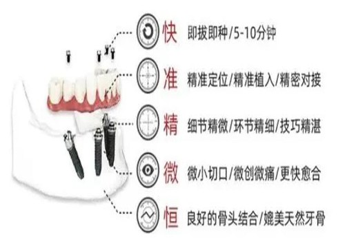 ALL-ON-4种植牙优势