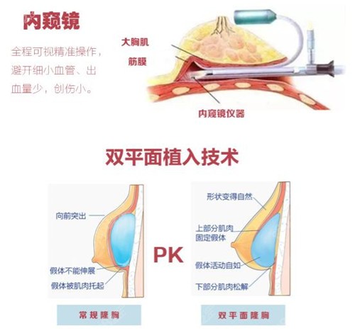 數(shù)字化隆胸