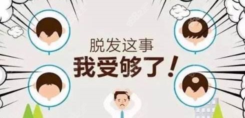 m型发际线脱发