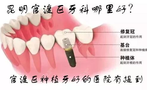 官渡区种看牙好的牙科医院