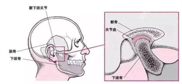 平导洞原理示意图图片