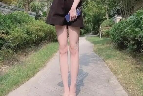 卢九宁医生直腿术术后