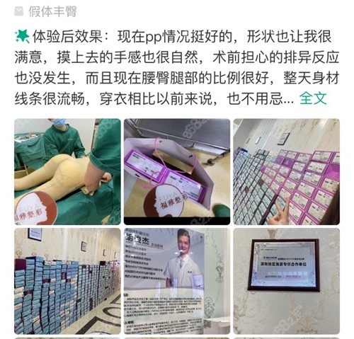 网友在深圳福雅医疗美容医院做假体丰臀评价
