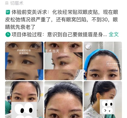 网友在深圳福雅医疗美容医院做提眉口碑评价
