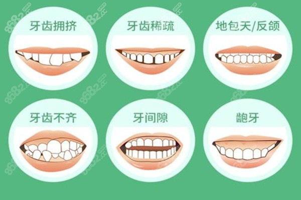做牙齿矫正的症状