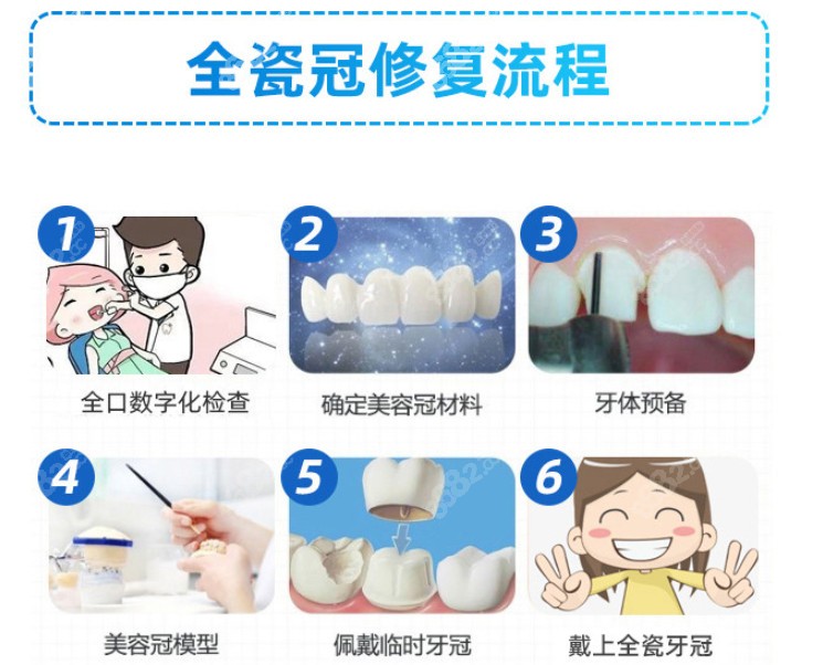 下图为全瓷牙冠的修复流程图